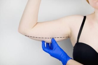 best arm fat reduction treatment